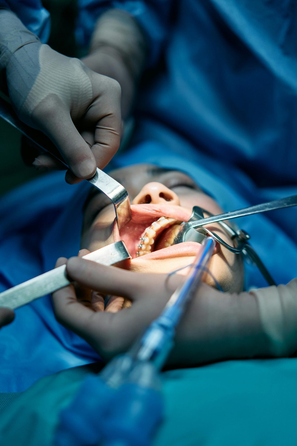 Evaluare pentru implant dentar la Platinum Dental, Slatina